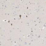 NELL2 Antibody in Immunohistochemistry (IHC)