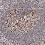 IWS1 Antibody in Immunohistochemistry (Paraffin) (IHC (P))