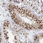 OFCC1 Antibody in Immunohistochemistry (Paraffin) (IHC (P))