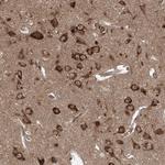 SERC1 Antibody in Immunohistochemistry (Paraffin) (IHC (P))