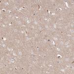 SERC1 Antibody in Immunohistochemistry (Paraffin) (IHC (P))