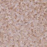 SERC1 Antibody in Immunohistochemistry (Paraffin) (IHC (P))