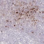 SERC1 Antibody in Immunohistochemistry (Paraffin) (IHC (P))