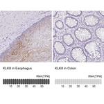 Kallikrein 8 Antibody in Immunohistochemistry (IHC)