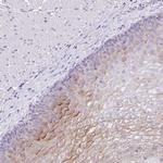 Kallikrein 8 Antibody in Immunohistochemistry (IHC)