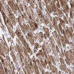 MYOZ2 Antibody in Immunohistochemistry (Paraffin) (IHC (P))