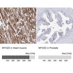 MYOZ2 Antibody in Immunohistochemistry (IHC)