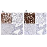 MYOZ2 Antibody in Immunohistochemistry (IHC)