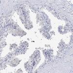 MYOZ2 Antibody in Immunohistochemistry (IHC)