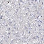 MYOZ2 Antibody in Immunohistochemistry (IHC)