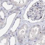 MYOZ2 Antibody in Immunohistochemistry (IHC)