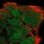 MYOZ2 Antibody in Immunocytochemistry (ICC/IF)