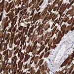 MYOZ2 Antibody in Immunohistochemistry (Paraffin) (IHC (P))