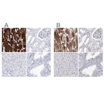 MYOZ2 Antibody in Immunohistochemistry (IHC)