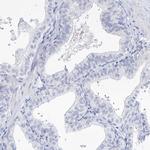 MYOZ2 Antibody in Immunohistochemistry (IHC)