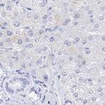 MYOZ2 Antibody in Immunohistochemistry (IHC)