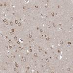 PPP2R3A Antibody in Immunohistochemistry (Paraffin) (IHC (P))