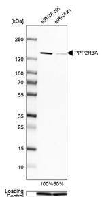 PPP2R3A Antibody in Western Blot (WB)