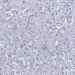 SLC4A7 Antibody in Immunohistochemistry (IHC)