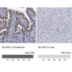 SLC4A7 Antibody