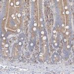 F1142 Antibody in Immunohistochemistry (Paraffin) (IHC (P))