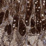 PAICS Antibody in Immunohistochemistry (Paraffin) (IHC (P))