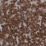 PLA2G12A Antibody in Immunohistochemistry (Paraffin) (IHC (P))