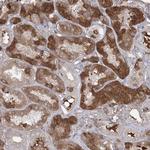 PEPP2 Antibody in Immunohistochemistry (Paraffin) (IHC (P))