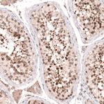 NUP54 Antibody in Immunohistochemistry (IHC)