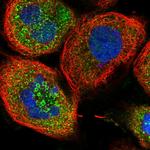 ZFYVE16 Antibody in Immunocytochemistry (ICC/IF)