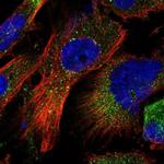 ZFYVE16 Antibody in Immunocytochemistry (ICC/IF)