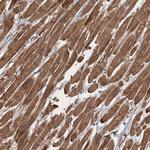 ZFYVE16 Antibody in Immunohistochemistry (Paraffin) (IHC (P))