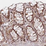 HARS2 Antibody in Immunohistochemistry (IHC)