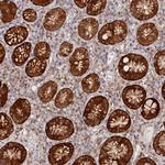 PAIP2 Antibody in Immunohistochemistry (Paraffin) (IHC (P))