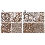 MUT Antibody in Immunohistochemistry (IHC)