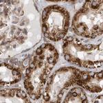 MUT Antibody in Immunohistochemistry (IHC)