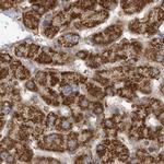 MUT Antibody in Immunohistochemistry (IHC)