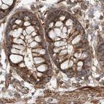 MUT Antibody in Immunohistochemistry (IHC)