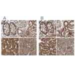 MUT Antibody in Immunohistochemistry (IHC)