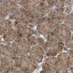 MUT Antibody in Immunohistochemistry (IHC)