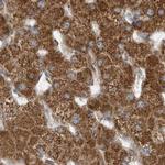 MUT Antibody in Immunohistochemistry (IHC)