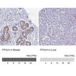 PTHLH Antibody in Immunohistochemistry (IHC)