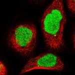 REPIN1 Antibody in Immunocytochemistry (ICC/IF)