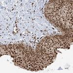 REPIN1 Antibody in Immunohistochemistry (Paraffin) (IHC (P))