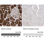 BDH2 Antibody in Immunohistochemistry (IHC)