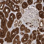 BDH2 Antibody in Immunohistochemistry (IHC)