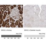 BDH2 Antibody