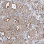 ADCK2 Antibody in Immunohistochemistry (Paraffin) (IHC (P))