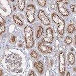 ADCK2 Antibody in Immunohistochemistry (Paraffin) (IHC (P))