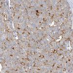 ADCK2 Antibody in Immunohistochemistry (Paraffin) (IHC (P))